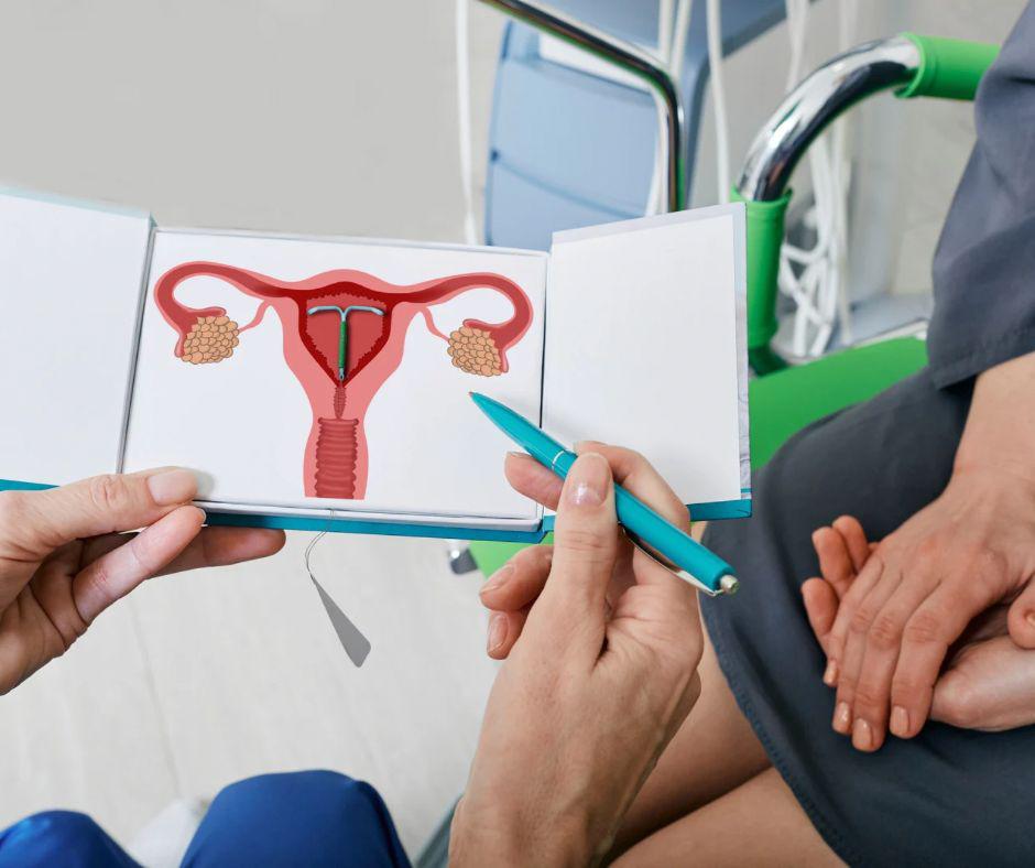Contracepție Sterilet Clasic, Mirena și Nexplanon img1