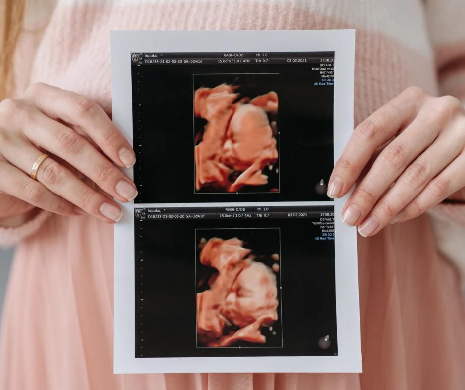 Diagnostic Prenatal Morfologie fetală, Amniocenteză și Teste Genetice img1