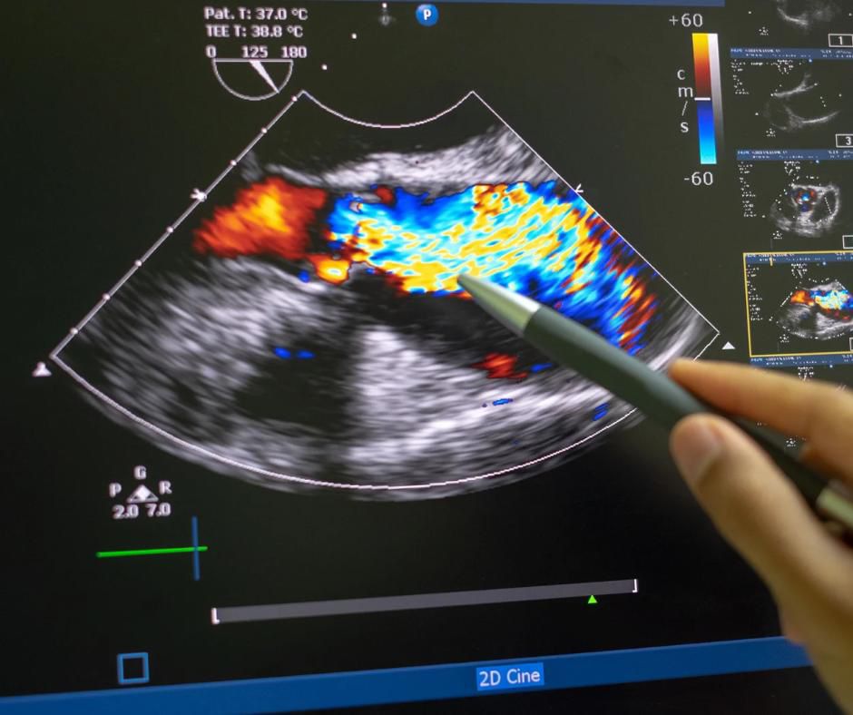 Diagnostic Prenatal Morfologie fetală, Amniocenteză și Teste Genetice img2